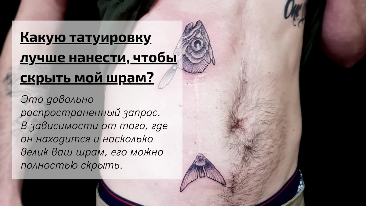 What type of tattoo do you use to cover my scar